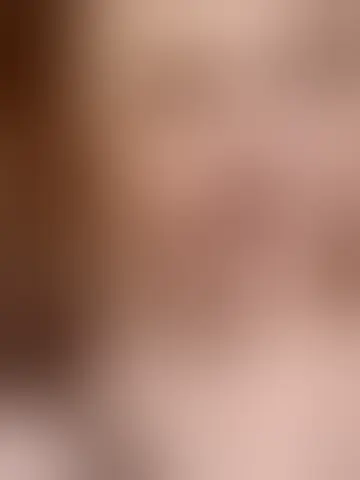 Photo of nalphes74372