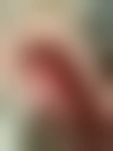 Photo of zobe